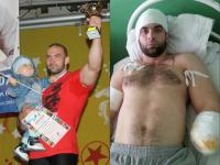 Донской чемпион по силовому экстриму лишился руки из-за удара током на таганрогском предприятии Донской чемпион по силовому экстриму лишился руки из-за удара током на таганрогском предприятии