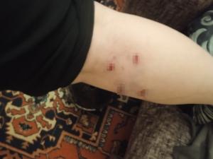 В Таганроге несколько собак покусали девушку